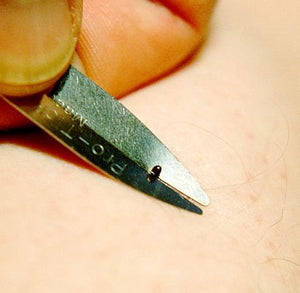 Protick Remedy Tick Removal Tool for Dogs Cats Horses People and Pets - Includes 5X Magnifier Tick ID Card