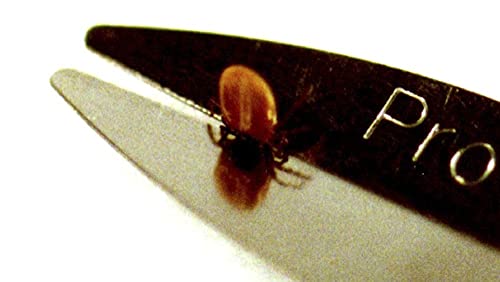 Protick Remedy Tick Removal Tool for Dogs Cats Horses People and Pets - Includes 5X Magnifier Tick ID Card